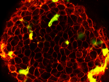 Islet Cell